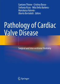Pathology of Cardiac Valve Disease